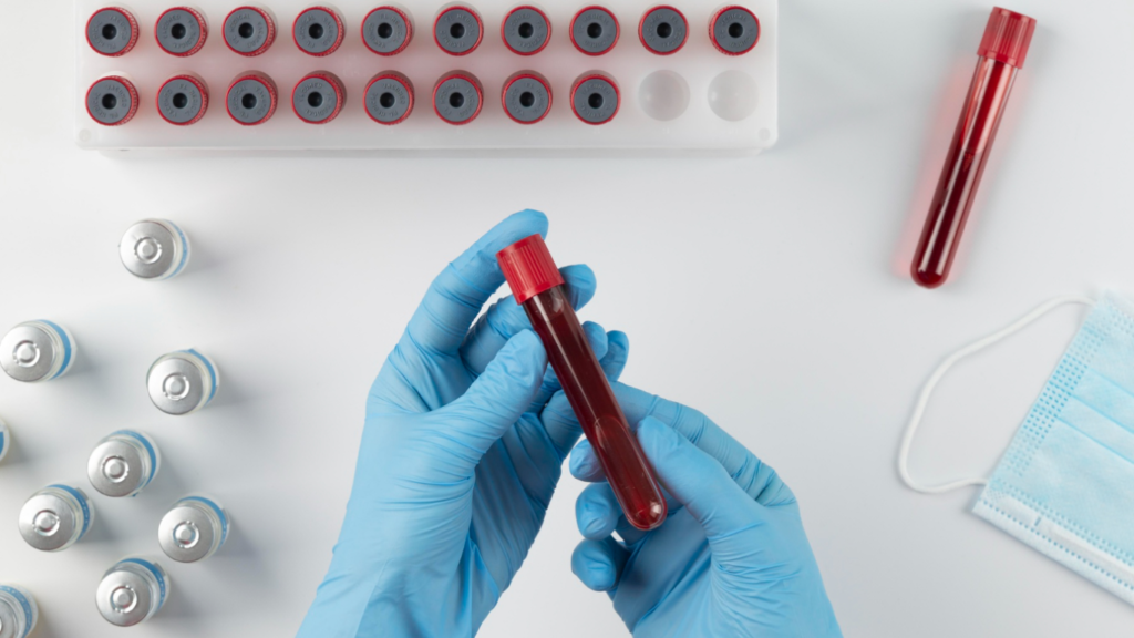 Profissinal com um tubo de sangue, fazendo um dos exames essenciais antes da reversão de vasectomia