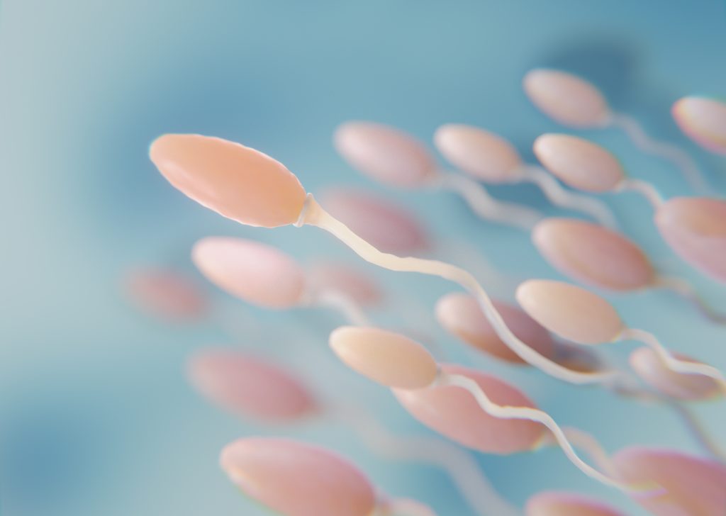 Como a varicocele impacta a qualidade do espermatozoide