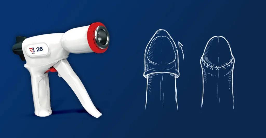 Postectomia afeta a sensibilidade